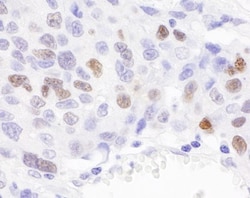 Importin alpha 2/KPNA2 Antibody, Novus Biologicals 0.1mL; Unlabeled:Antibodies,